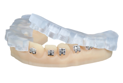 keyortho IBT DLP makeyortho IBT DLP material.pngterial.png