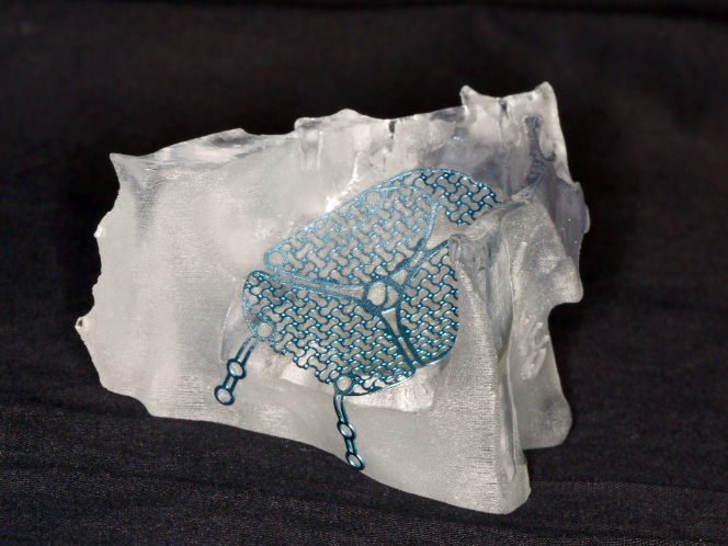 Patient-specific 3D printed models enable preparation of hybrid titanium
mesh implants prior to surgery, reducing operating time.