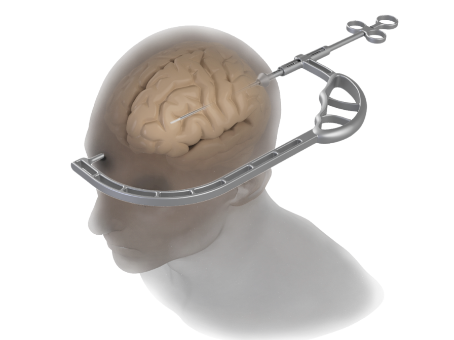 Multiple iterations of the Caroline Guide were printed on the F370
FDM printer for ergonomic and functional evaluations before the&nbsp; final model was fabricated in metal.