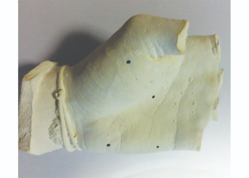 Previous prosthesis molds produced in chalk
resulted in expensive shipping costs and
were prone to damage during transit.