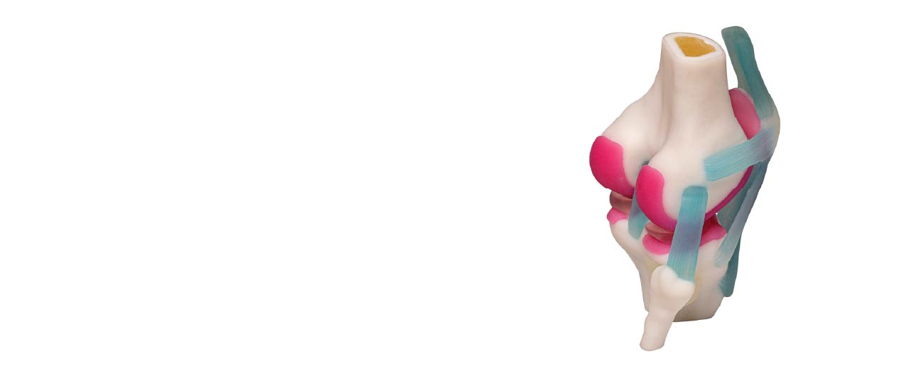 patella image