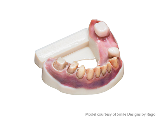 color model J5 DentaJet