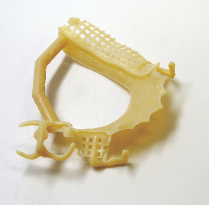 A removable partial framework model 3D printed in MED620 material.