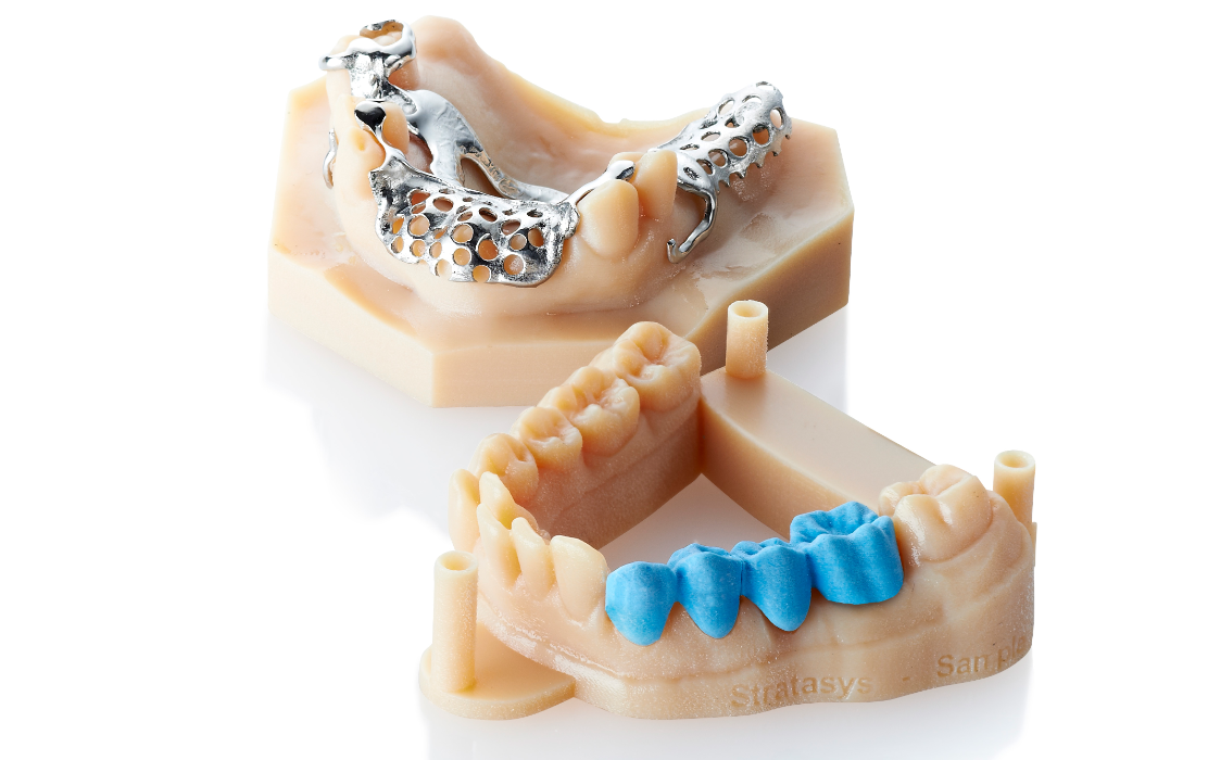 A removable partial framework model 3D printed in MED620 material.