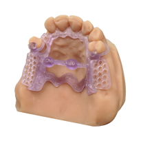 KeyCast® by Keystone Industries