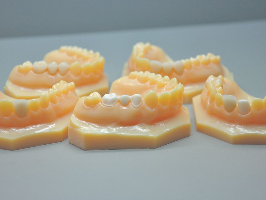 The Objet Eden260V 3D Printer helped eliminate fit
issues and patient discomfort caused by inaccuracies
in restorations.