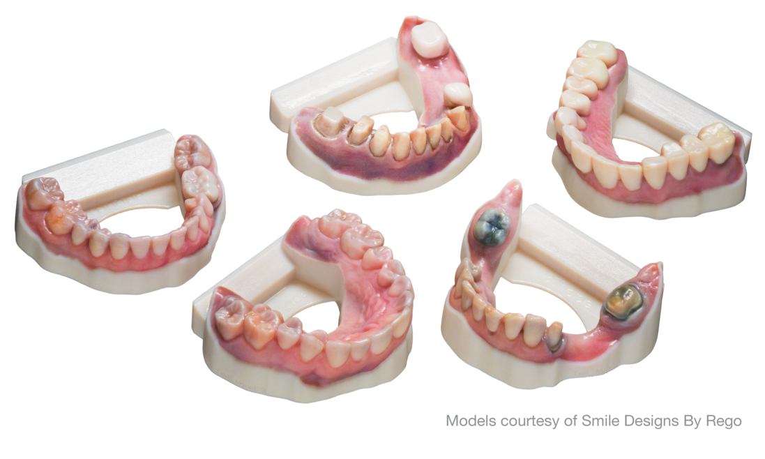 Dental models