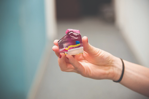 A personalized color-coded 3D print of a patient specific imaged part. 