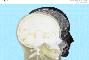 rsna-2025