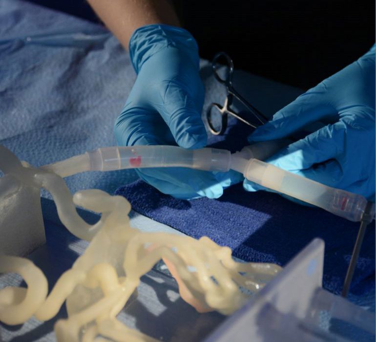 Applying 3D printing to vascular models.