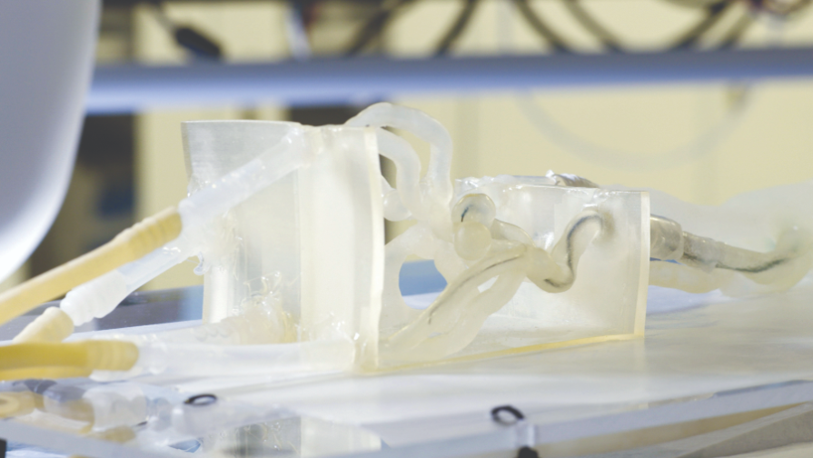 3D printing unlocks new opportunities to advance vascular care.