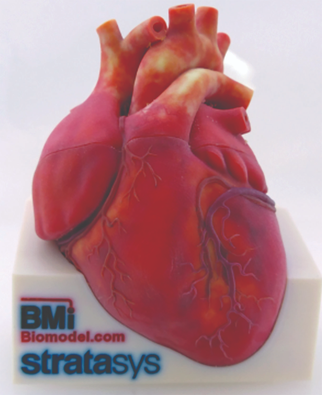 BMI’s heart model shows the Stratasys J750’s ability to print
realistic colors.&nbsp;