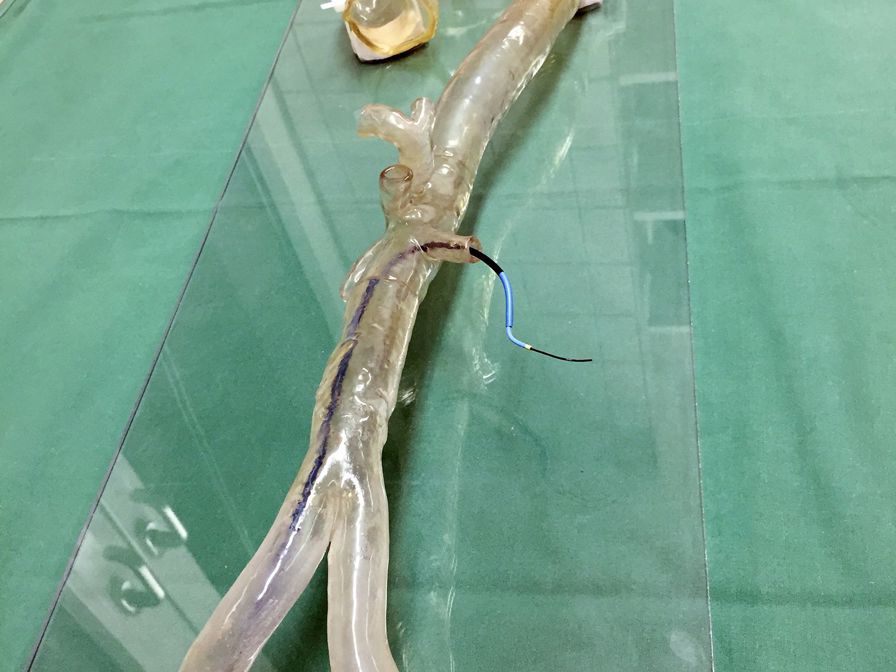 Transparent 3D printed model of a patient-specific aortic arch used by the University Hospital Mainz to practice complex endovascular surgeries.