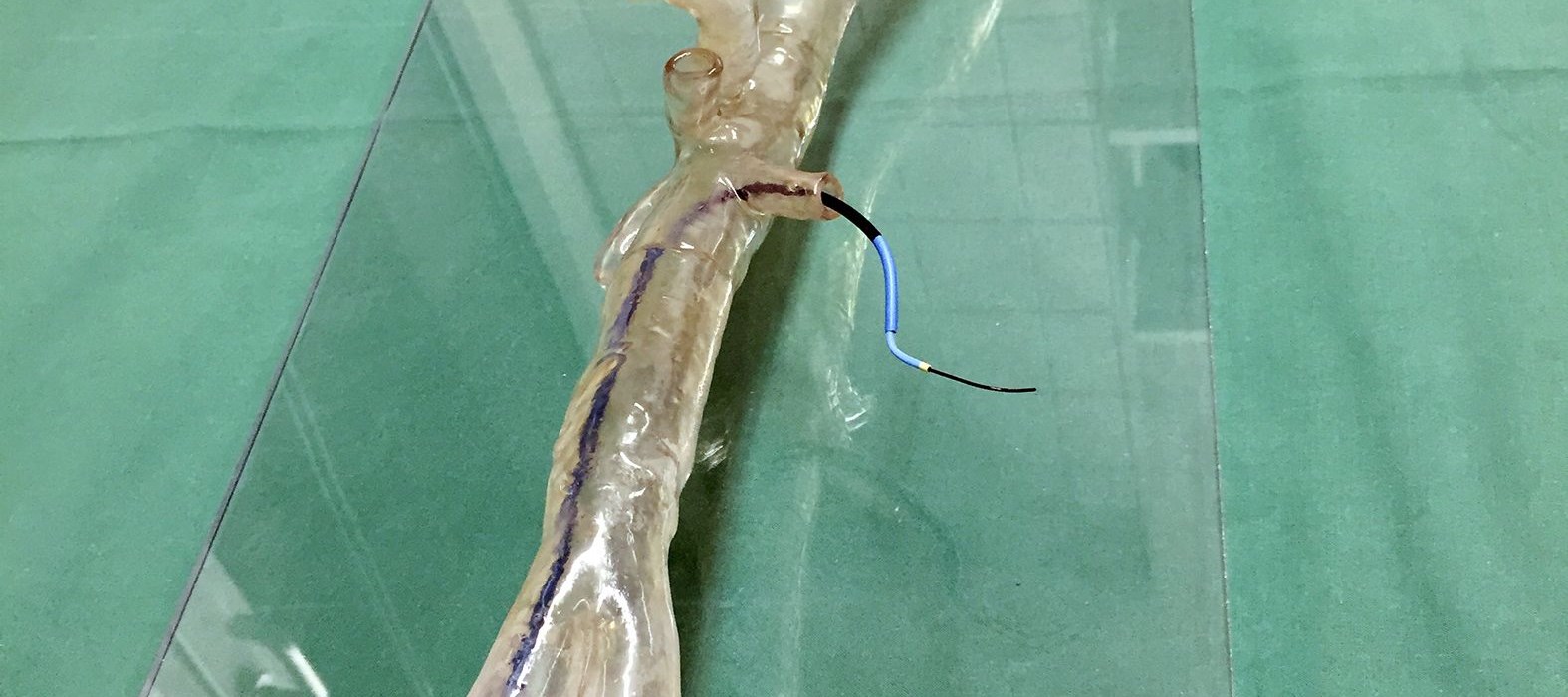 Transparent 3D printed model of a patient-specific aortic arch used by the University Hospital Mainz to practice complex endovascular surgeries.