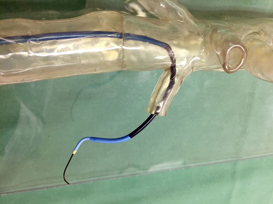 Surgeons use a highly-accurate, transparent
3D printed model to practice the complex
implant of a stent through the patient’s
arteries.