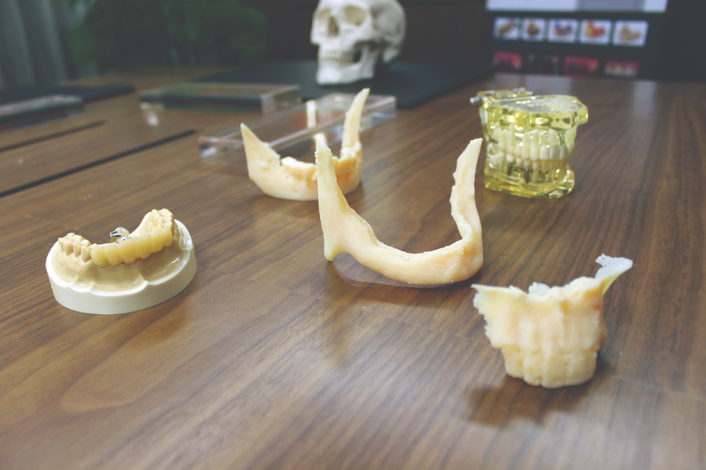 3D printed dental models used to test fitting of fixtures