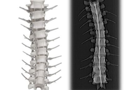 DICOM anatomy 3D printed