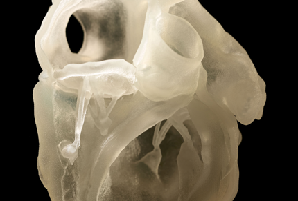 Medtronic DAP Myocardium