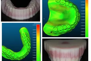 dental-model-scan.