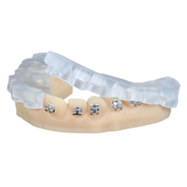 KeyOrtho-IBT origin one dental