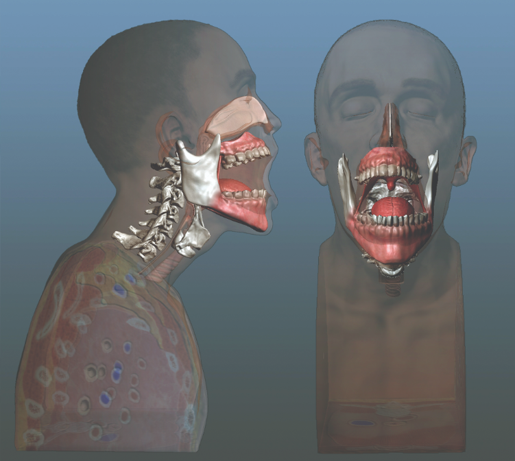 <div>Human geometry taken from MRI and CT scans provided</div><div>the starting point for 3D printing.</div>