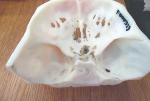 Interior view of the 3D facial model