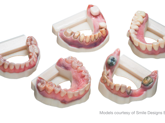 Color dental model​s