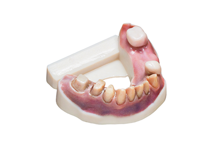 vero-vivid-material-3d-dental