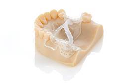 rpd-model-med620-and-casting-pattern-med610