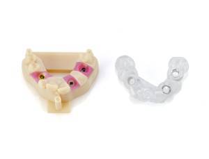 Implantology