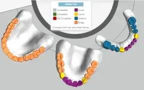 grabcad-print-showing-bridged-denture-teeth