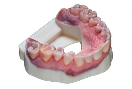 3d printed denture full color