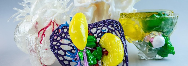 3d-printed-medical-models