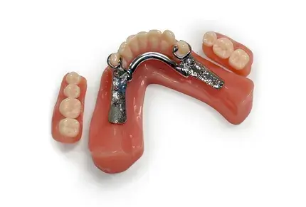 Retention Pin Design