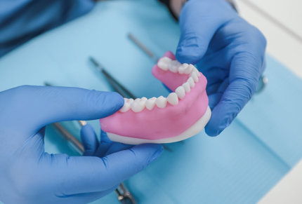 3D printed dental model using Stratasys DentaJet