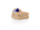 Orthodontic model