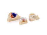 image gallery dental materials ortho appliance implant model carousel