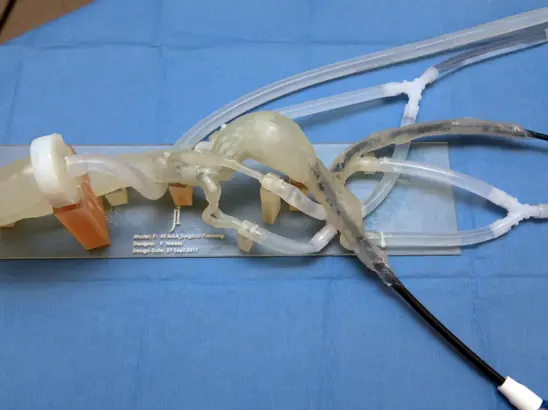 abdominal-aortic-aneurysm