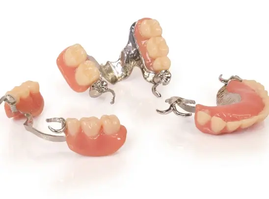 3D printed Stratasys TrueDent RPDs with metal frames.