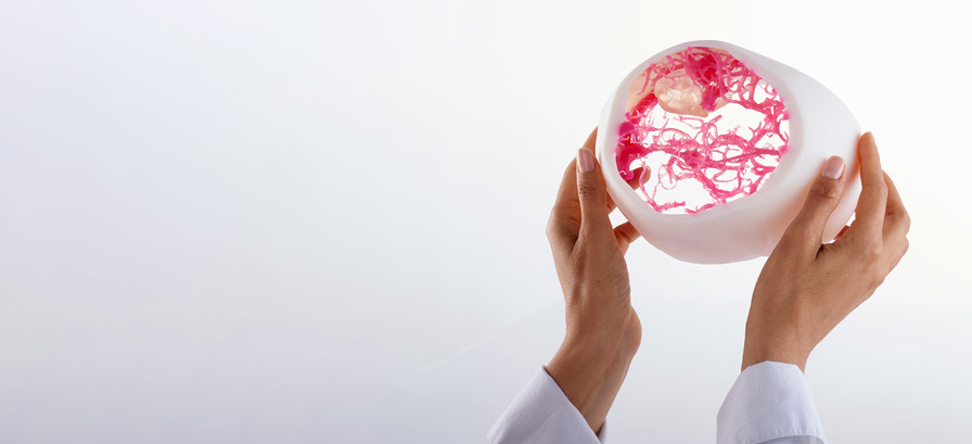 Pre surgical Planning