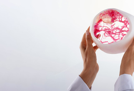 Pre surgical Planning