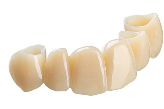 The TrueDent Difference: A new resin for 3D printing of permanent dentures and temporary crowns and bridges.