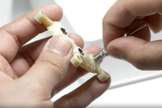 Implant Guide 3D Printed on Stratasys J5 DentaJet