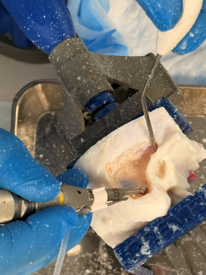 3D 프린팅된 Stratasys PolyJet 수술용 모델의 후처리
