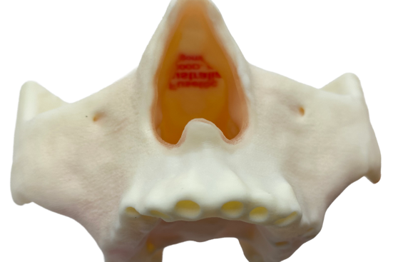 FuseTec used a Stratasys 3D printer to create a partial skull for dental training