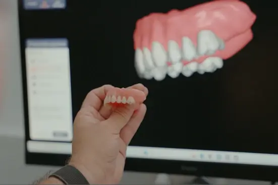 One-piece prosthetic printing a digital scan to 3D printed denture