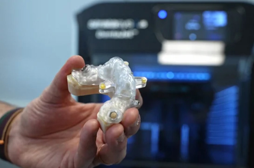 The Solution: 5X Surgical Guide Production with DentaJet