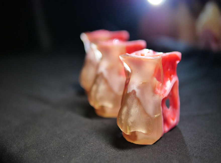 3D printed medical model of a nose.