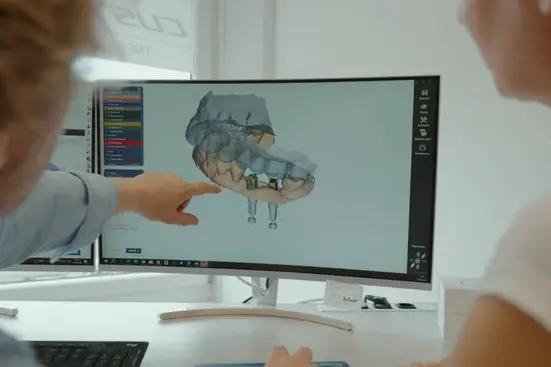digital implant planning software