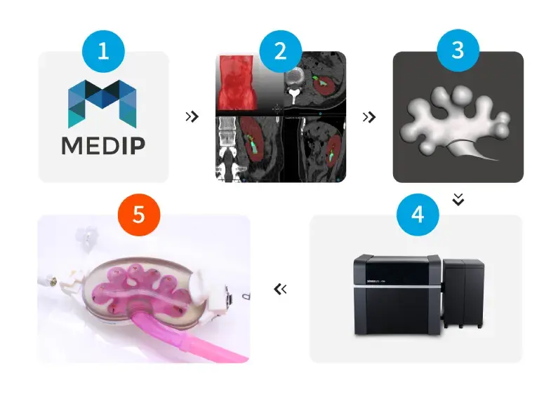MEDIP_PROCESS